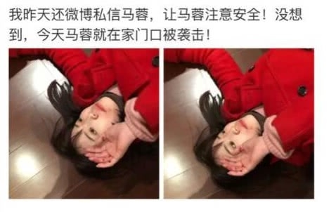 马蓉在家门口被打，身体多处受伤，在急诊室声称是王宝强做的