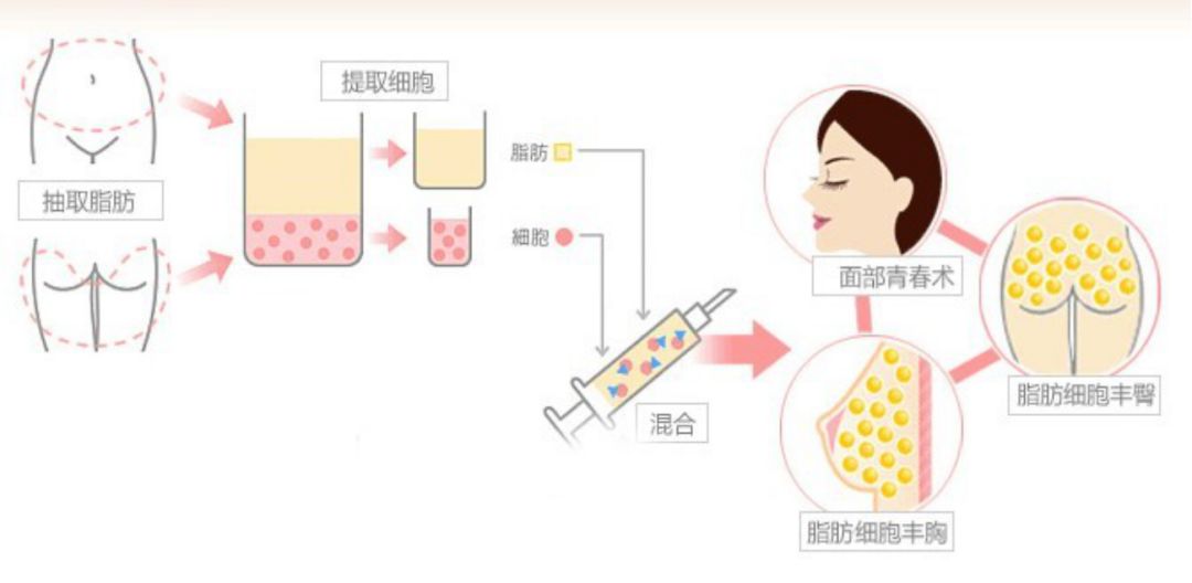 回春没多久的杨紫，咋又肿成这样了？