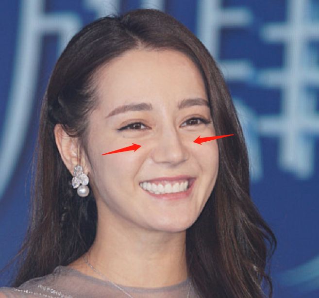 好气哦！那么美的热巴，却被脸上这块肉肉毁了颜值！