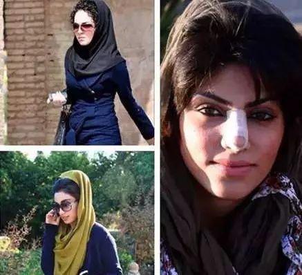 12岁整鼻到20岁还没拆绷带，只是为了炫富？