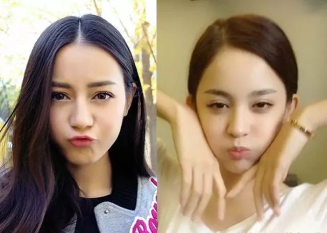 12岁整鼻到20岁还没拆绷带，只是为了炫富？