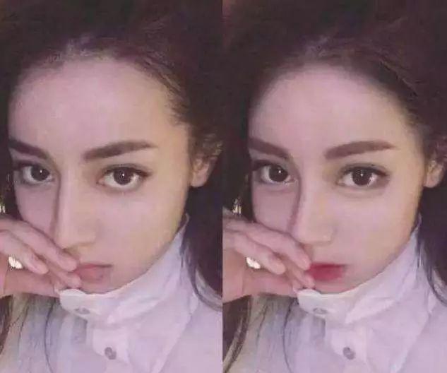 12岁整鼻到20岁还没拆绷带，只是为了炫富？