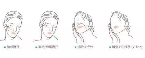 赵薇拉皮把眼睛拉飞了？！