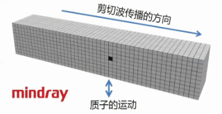 剪切波弹性成像:于细微处见真知