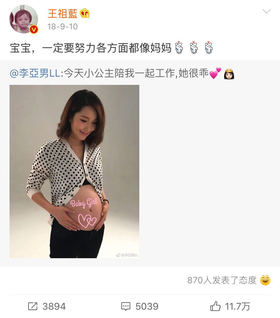 基因太强大！李亚男晒女儿大眼超萌正面照，像极了王祖蓝的妈妈！