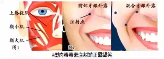 天仙刘亦菲的致命bug!竟然是这里