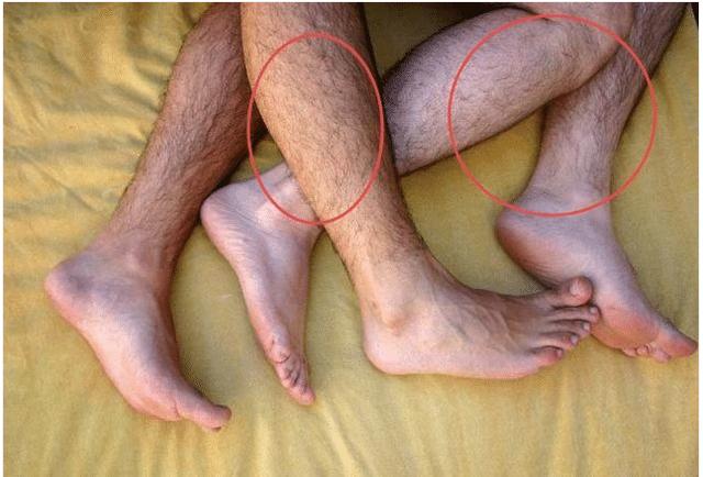 为什么男生们的腿毛浓密程度各有不同?有关专家给出以下答案