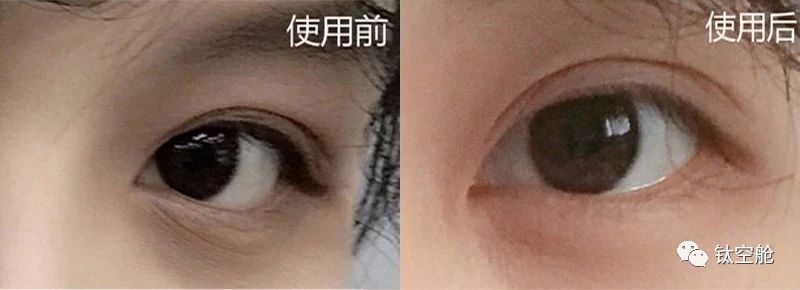 眼睛不会说谎，每天滚一滚开启“养眼”模式，1分钟眼部SPA，好用到没朋友｜钛空舱