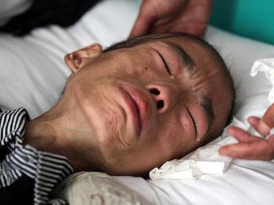 患癌症后，就要忌口鸡蛋吗？很多人做错了，肿瘤医师通知你答案