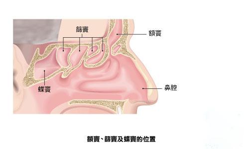 定期复查清理鼻腔,有效减低复发