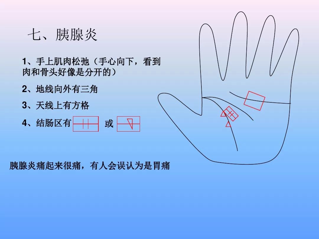 最全手诊(一看就懂)
