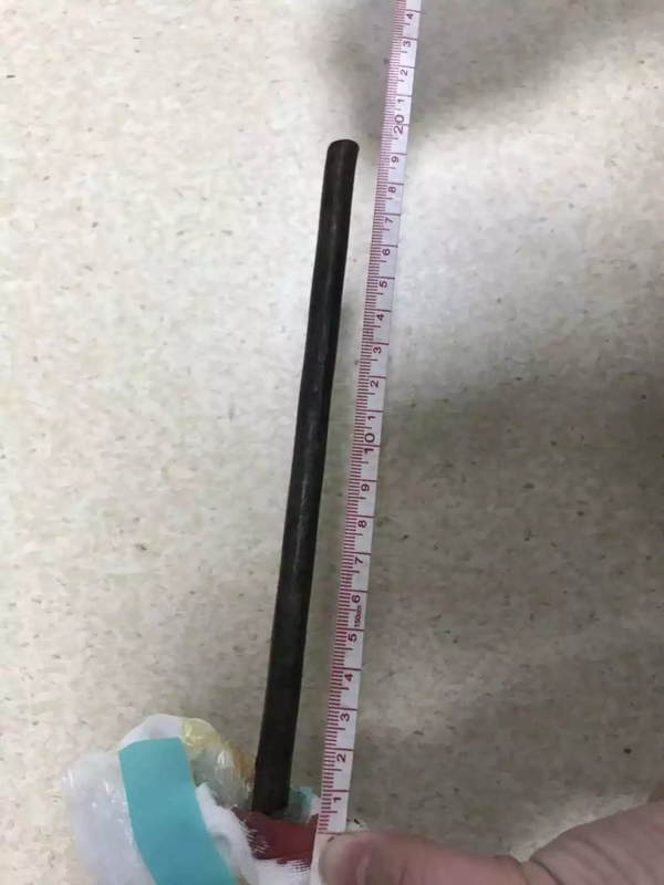 铁棒从天而降,穿透身体离心脏仅0.5厘米