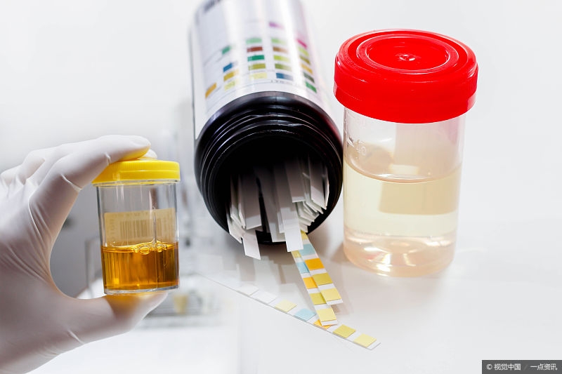 如何从尿液判断身体健康 尿黄带红或是尿路感