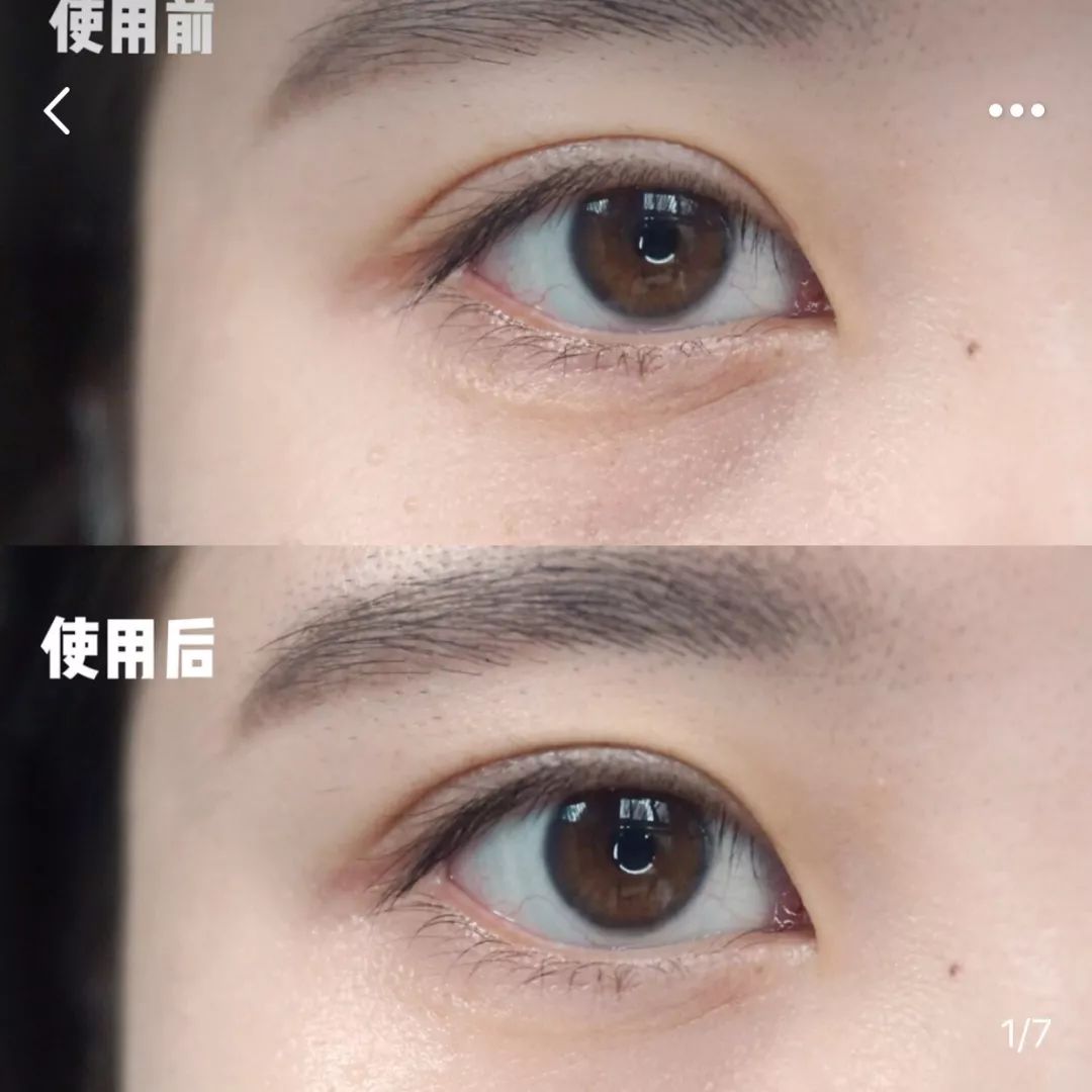 比同龄人老怎么办？