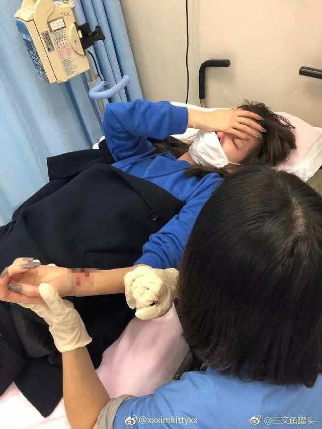 因跟歌手男友分手被指花心，女模不堪舆论压力割腕轻生送院！