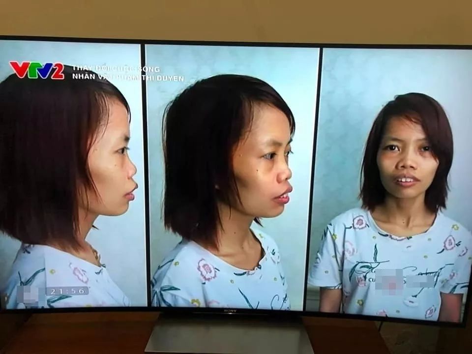越南丑女逆袭记