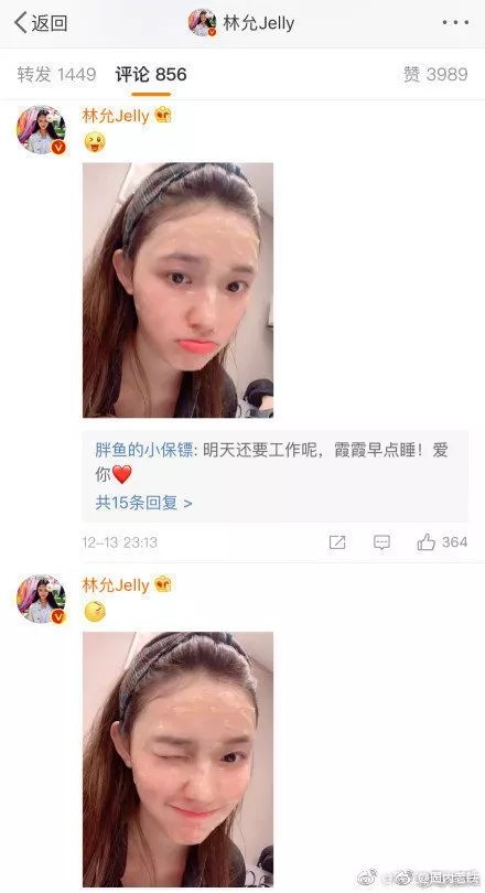 她的脸变成了梯形，彻底垮了！难道又要怪整牙