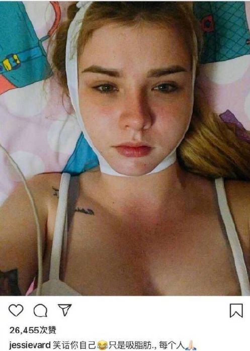 这个19岁网红，po出了自己整容的全过程