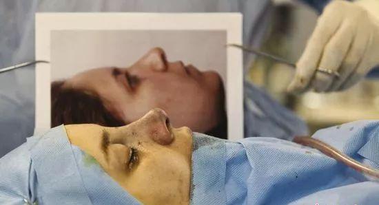 12岁整鼻到20岁还没拆绷带，只是为了炫富？