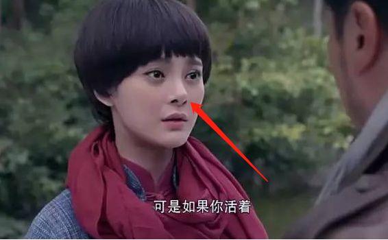 王凯初恋整成低配版沈梦辰！连她整形后遗症的朝天鼻也照搬了···