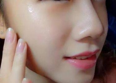 宁静自曝在瑞士打针全脸被扎900下!还被骗了钱?