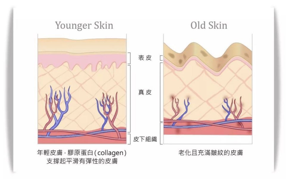 使胶原纤维容易断裂,造成皮肤更容易衰老,失去弹性