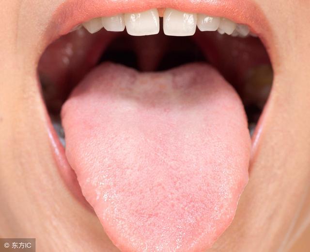 医生教你6大方法,看舌头懂健康,收藏备用!