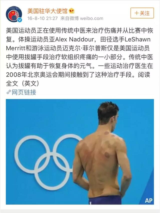 老外们为何迷上了中国的拔罐……