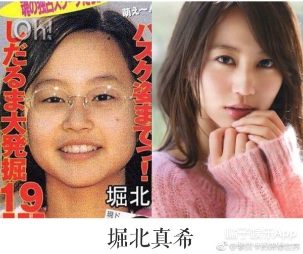 她这下巴是不是整失败了？
