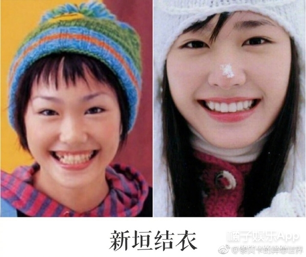 她这下巴是不是整失败了？