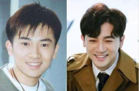 苏有朋把自己整成林峯！为什么男人这么爱动下巴？！