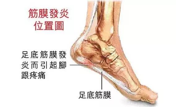 你知道吗,在运动中鞋垫比鞋更重要!