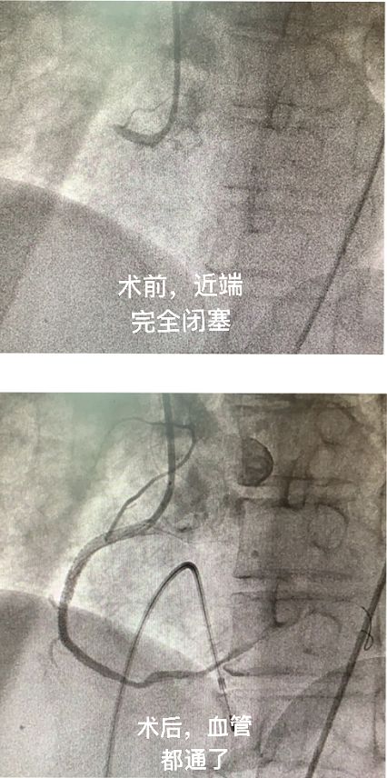 後事進行到一半，老人突然舉高雙手睜開眼睛「復活」，醫生：奇跡的關鍵是…… 健康 第7張