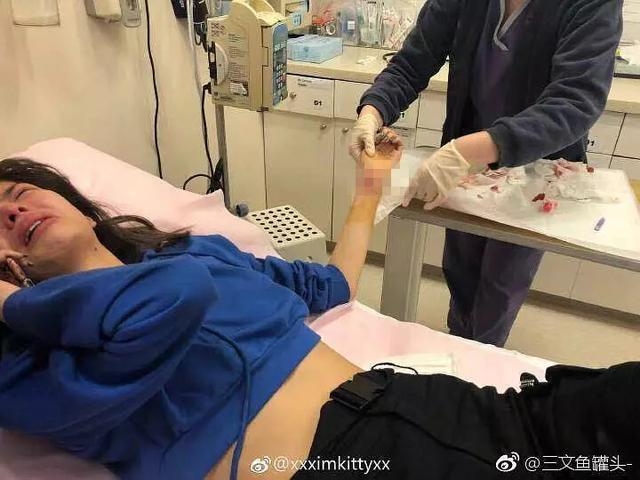 因跟歌手男友分手被指花心，女模不堪舆论压力割腕轻生送院！