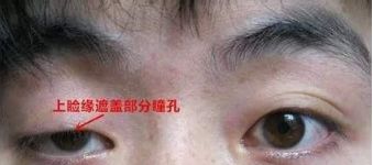 林允的大小眼已经严重到变成“肌无力”了···