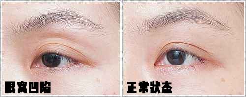 为什么瘦下来的赵丽颖反而显老？这点不注意小心你也中招！