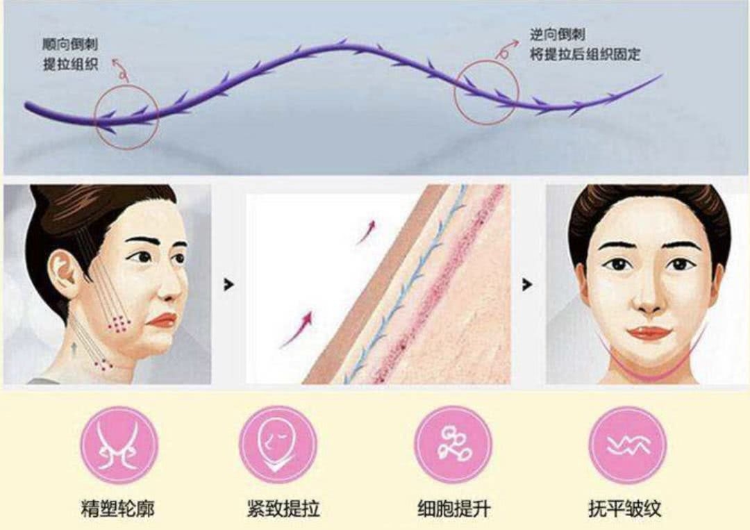 董洁这脸是返厂了吗？
