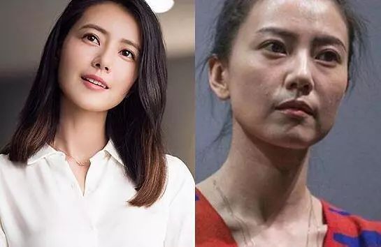 可怕！当红女明星脸上集体出现了这个东西！