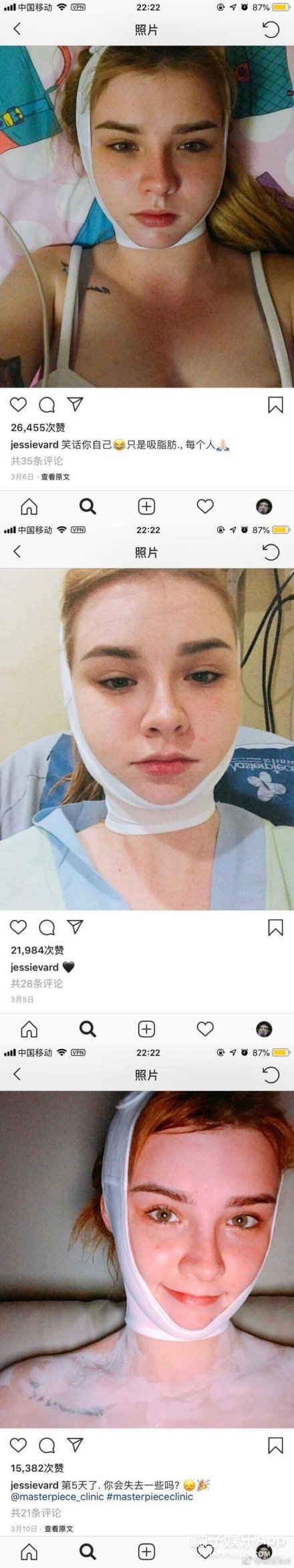 晚报|金莎为翻唱歌曲找寻著作人 爱尔兰名模整容过程曝光