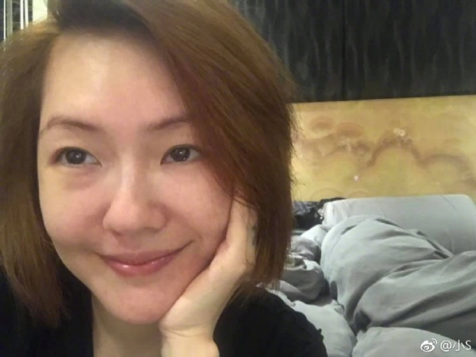 小s自曝脸上的肉毒杆菌和玻尿酸快消失了，她为此感到开心