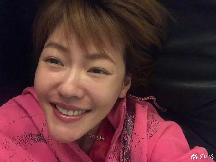 小s自曝脸上的肉毒杆菌和玻尿酸快消失了，她为此感到开心