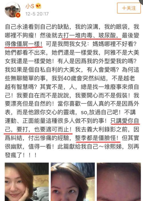 这个19岁网红，po出了自己整容的全过程