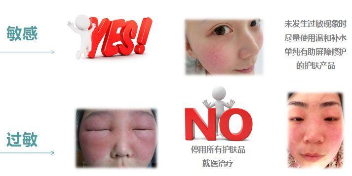 什么都不怕的韩雪，遇到这种事也没辙了