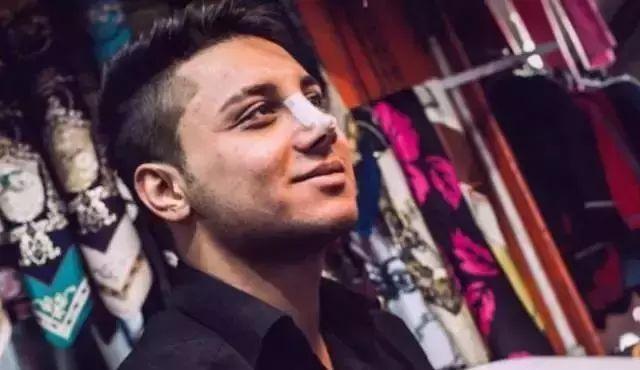 12岁整鼻到20岁还没拆绷带，只是为了炫富？