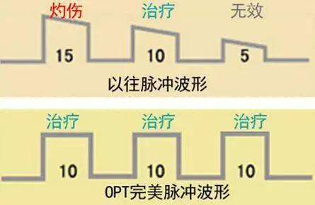 高清镜头下皮肤无瑕疵的周冬雨，真的一次都没失误过？