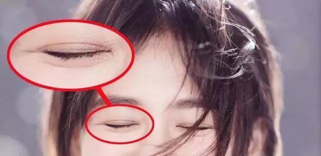 瞎整派掌门人杨紫终于翻身了，这个部位整得一雪前耻！