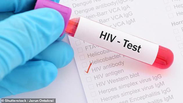 艾滋病有望治愈?法国科学家成功摧毁感染HIV病毒细胞