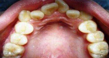 被男主角吐槽演吻戏不刷牙,口臭到拍不下去··· 白瞎了这个颜值惹!