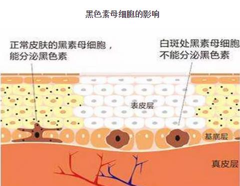 白白讲坛 原来黑色素母细胞对祛白至关重要