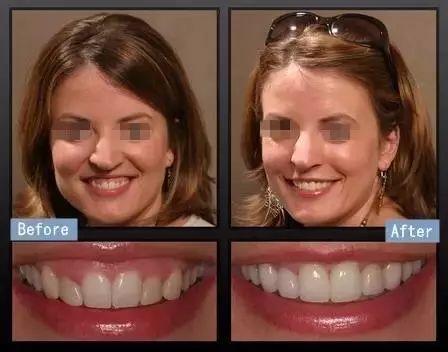 天仙刘亦菲的致命bug!竟然是这里